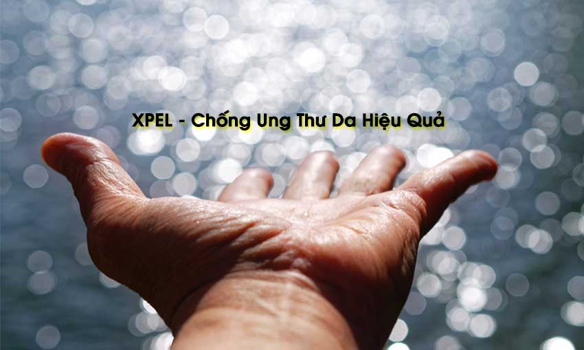 XPEL VÀ CÔNG CUỘC BẢO VỆ SỨC KHOẺ CHO NGƯỜI TIÊU DÙNG